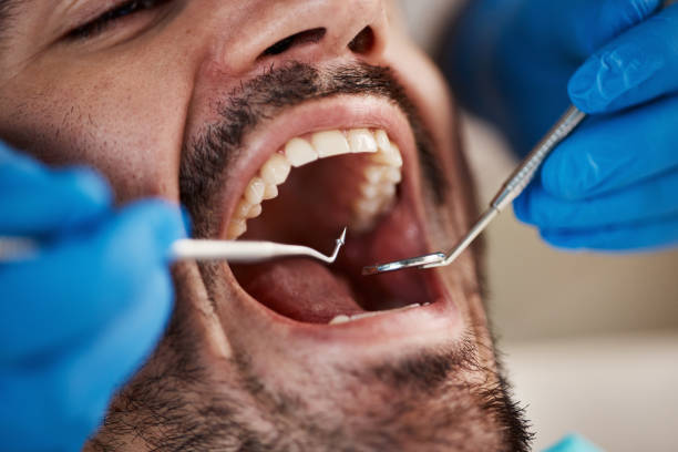 Best Pediatric Emergency Dentist in Rocky Top, TN